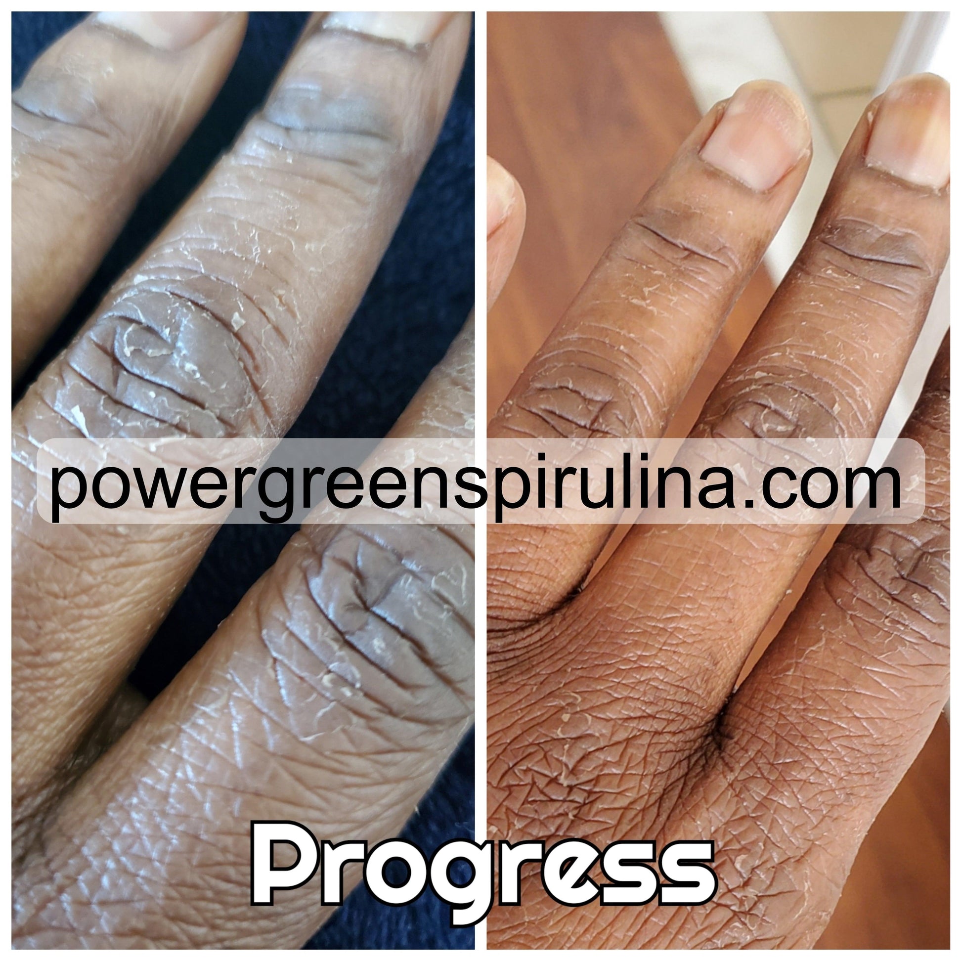 Extreme Dark knuckle Treatment Cream - Power Green Spirulina