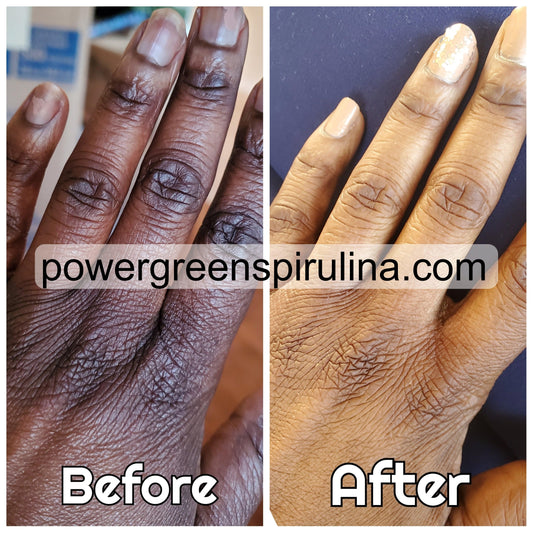 Extreme Dark knuckle Treatment Cream - Power Green Spirulina