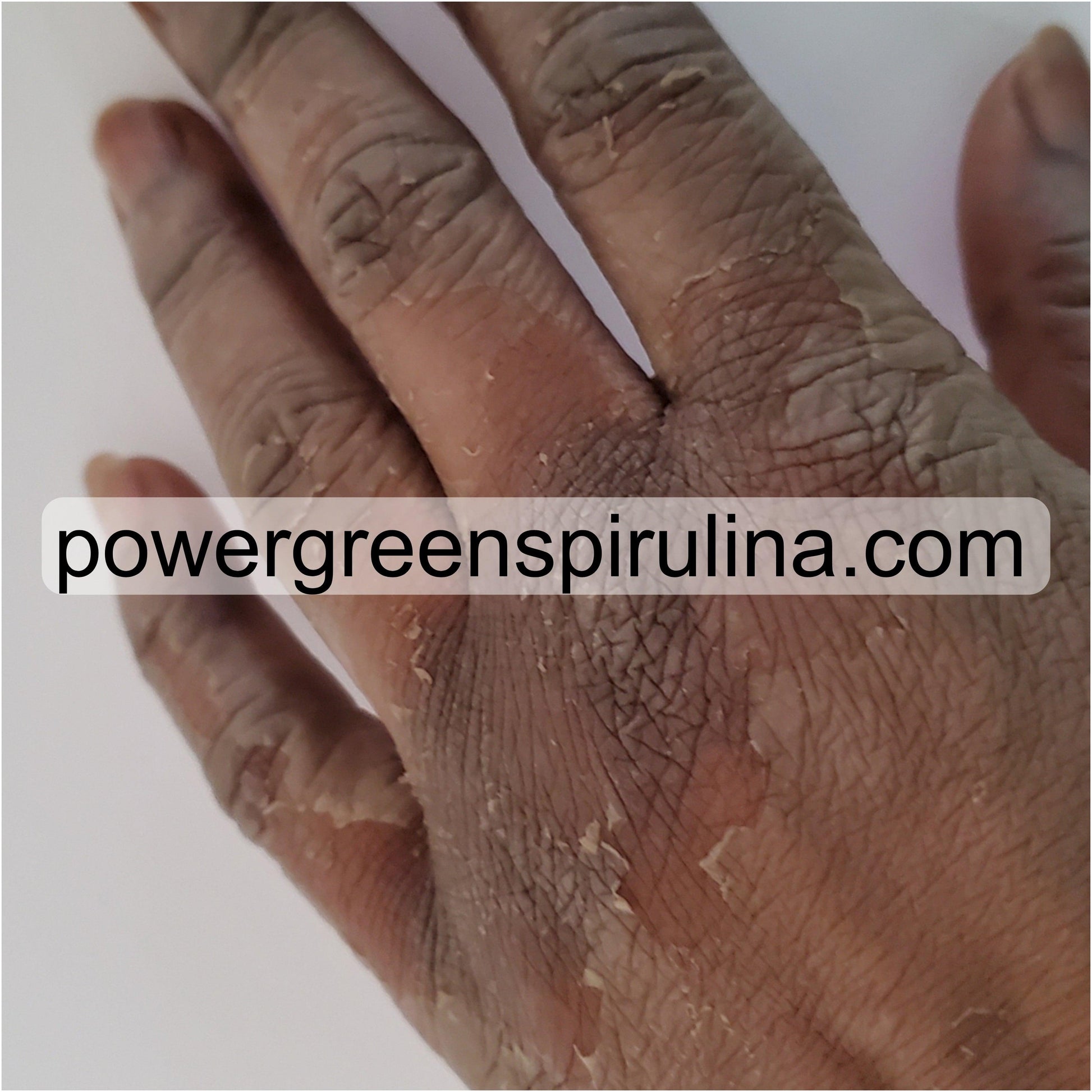 Extreme Dark knuckle Treatment Cream - Power Green Spirulina