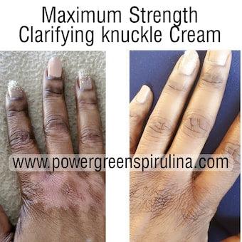 Maximum Strength Clarifying knuckle Cream - Power Green Spirulina